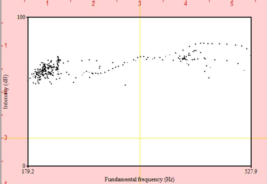Voice range profile with fundamental frequency on x-axis and intensity on y-axis